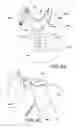 Fig. 07 - Thoracic lumbar sacral orthosis