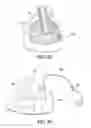 Fig. 09 - Thoracic lumbar sacral orthosis