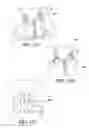 Fig. 13 - Thoracic lumbar sacral orthosis