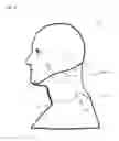 Fig. 06 - Neck orthosis