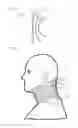 Fig. 12 - Neck orthosis