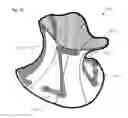 Fig. 14 - Neck orthosis