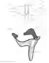 Fig. 16 - Neck orthosis
