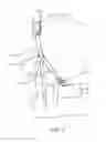 Fig. 03 - Device and method for elevating a distal extremity