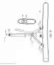 Fig. 12 - Device and method for elevating a distal extremity