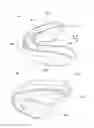 Fig. 01 - ORAL APPLIANCE