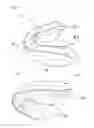 Fig. 02 - ORAL APPLIANCE