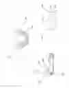 Fig. 11 - ORAL APPLIANCE