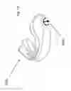 Fig. 12 - ORAL APPLIANCE