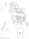 Fig. 09 - Therapeutic agent delivery device with advanceable cannula and needle