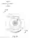Fig. 10 - Therapeutic agent delivery device with advanceable cannula and needle