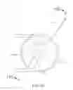 Fig. 19 - Therapeutic agent delivery device with advanceable cannula and needle