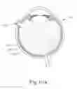 Fig. 20 - Therapeutic agent delivery device with advanceable cannula and needle