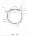 Fig. 23 - Therapeutic agent delivery device with advanceable cannula and needle
