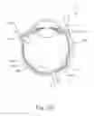 Fig. 25 - Therapeutic agent delivery device with advanceable cannula and needle