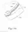 Fig. 27 - Therapeutic agent delivery device with advanceable cannula and needle