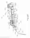 Fig. 47 - Therapeutic agent delivery device with advanceable cannula and needle