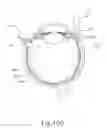 Fig. 23 - Method and apparatus for sensing position between layers of an eye