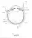 Fig. 24 - Method and apparatus for sensing position between layers of an eye
