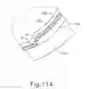 Fig. 27 - Method and apparatus for sensing position between layers of an eye