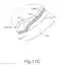 Fig. 29 - Method and apparatus for sensing position between layers of an eye