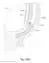 Fig. 46 - Method and apparatus for sensing position between layers of an eye