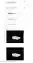 Fig. 03 - MACULAR SPARING CONTROL METHOD AND CONTROL SYSTEM FOR OPHTHALMIC LASER TREATMENT DEVICE