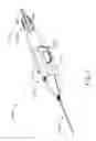 Fig. 08 - Motorized suprachoroidal injection of therapeutic agent