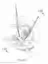 Fig. 14 - Motorized suprachoroidal injection of therapeutic agent