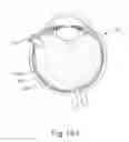 Fig. 20 - Motorized suprachoroidal injection of therapeutic agent