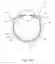 Fig. 24 - Motorized suprachoroidal injection of therapeutic agent