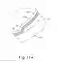 Fig. 27 - Motorized suprachoroidal injection of therapeutic agent