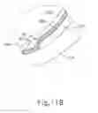 Fig. 28 - Motorized suprachoroidal injection of therapeutic agent