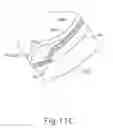 Fig. 29 - Motorized suprachoroidal injection of therapeutic agent