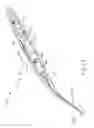 Fig. 31 - Motorized suprachoroidal injection of therapeutic agent