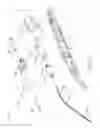 Fig. 33 - Motorized suprachoroidal injection of therapeutic agent