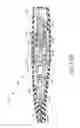 Fig. 35 - Motorized suprachoroidal injection of therapeutic agent