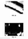 Fig. 11 - Apparatus for patterned plasma-mediated laser ophthalmic surgery