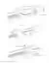 Fig. 09 - Devices and methods for the removal of lenticular tissue