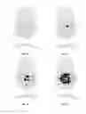 Fig. 04 - LASER APPARATUS AND METHOD FOR REFRACTIVE SURGERY
