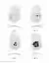 Fig. 04 - Laser apparatus and method for refractive surgery