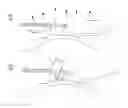 Fig. 06 - Laser apparatus and method for refractive surgery