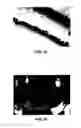 Fig. 11 - Apparatus for patterned plasma-mediated laser ophthalmic surgery