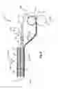 Fig. 10 - PROCESS FOR MAKING AN ABSORBENT ARTICLE COMPRISING A TOPSHEET/ACQUISITION LAYER LAMINATE