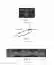 Fig. 02 - ABSORBENT ARTICLES WITH CHANNEL CONFIGURATIONS