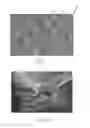 Fig. 08 - ABSORBENT ARTICLES WITH CHANNEL CONFIGURATIONS
