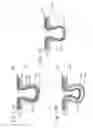 Fig. 09 - ABSORBENT ARTICLES WITH CHANNEL CONFIGURATIONS