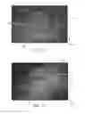Fig. 11 - ABSORBENT ARTICLES WITH CHANNEL CONFIGURATIONS
