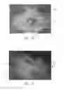 Fig. 12 - ABSORBENT ARTICLES WITH CHANNEL CONFIGURATIONS