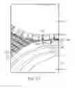 Fig. 15 - ABSORBENT ARTICLES WITH CHANNEL CONFIGURATIONS